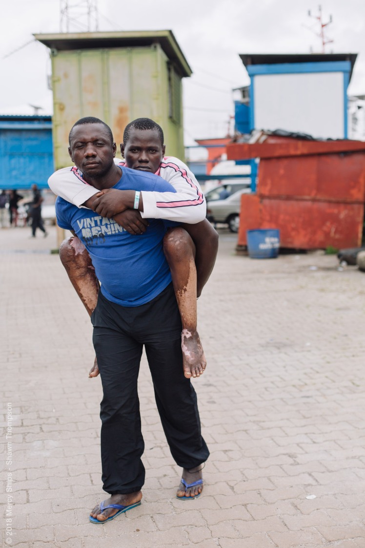 Ibrahima, plastics patient, being carried by his brother before surgery.